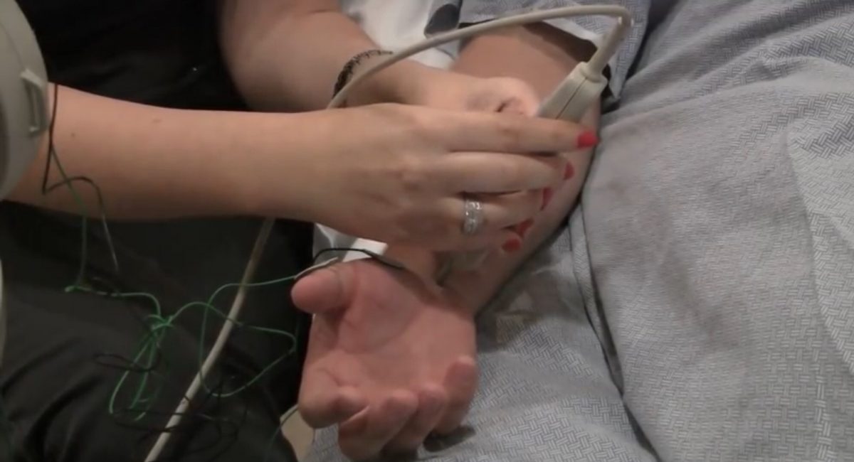 Nerve Conduction Study – EMG Test Electromyogram - Jamie Boyle Guillain Barre Syndrome -GBS Recovery